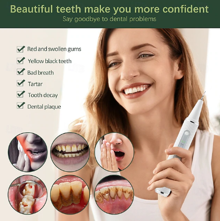 Vivolux | Dental Scaler | Ultrasonic Tartar Remover Tool for Home Use 1