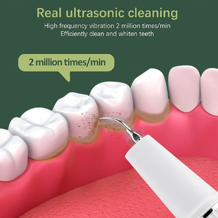 Vivolux | Dental Scaler | Ultrasonic Tartar Remover Tool for Home Use 3