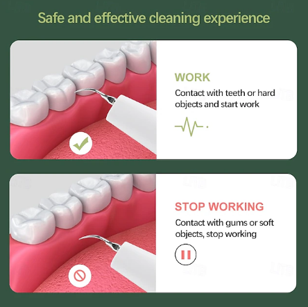 Vivolux | Dental Scaler | Ultrasonic Tartar Remover Tool for Home Use 4