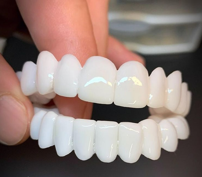 Realistic Dental Implants for Perfect Smile Replacement - Fesara
