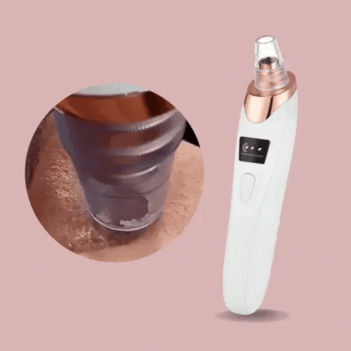 Easy Pore Cleaner Blackhead Remover Device - Fesara