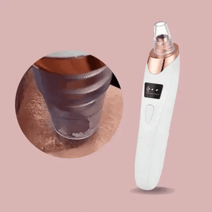 Easy Pore Cleaner Blackhead Remover Device - Fesara