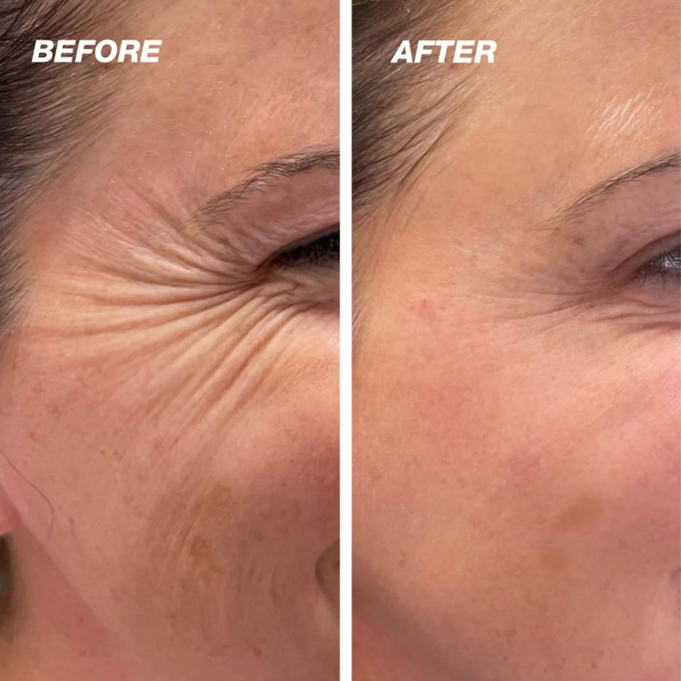 Clear Skin Serum for Glowing Complexion