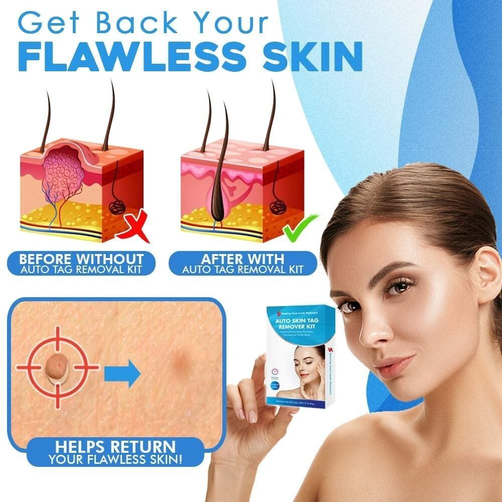 Easy Hair Removal Device for Smooth Skin
