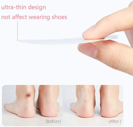 Comfort Gel Blister Prevention Pads - Fesara