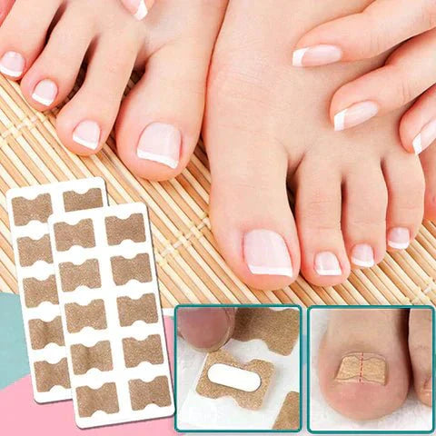 Easy To Use Nail Correction Strips for Ingrown Nails - Fesara