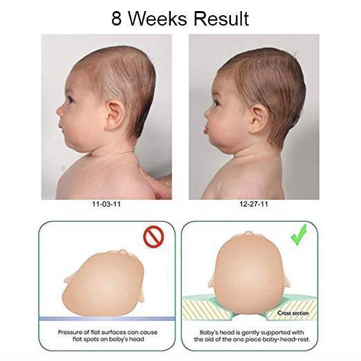 Baby Head Support Pillow for Flat Head Prevention