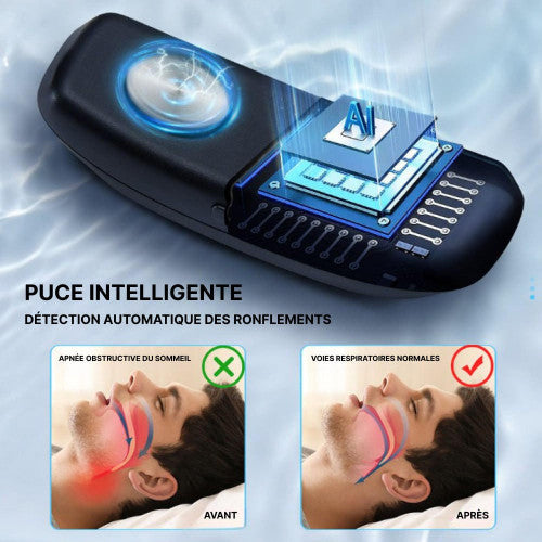 Fesara | Best Anti Snore Solution Device