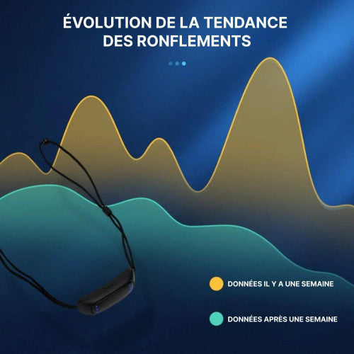 Fesara | Best Anti Snore Solution Device