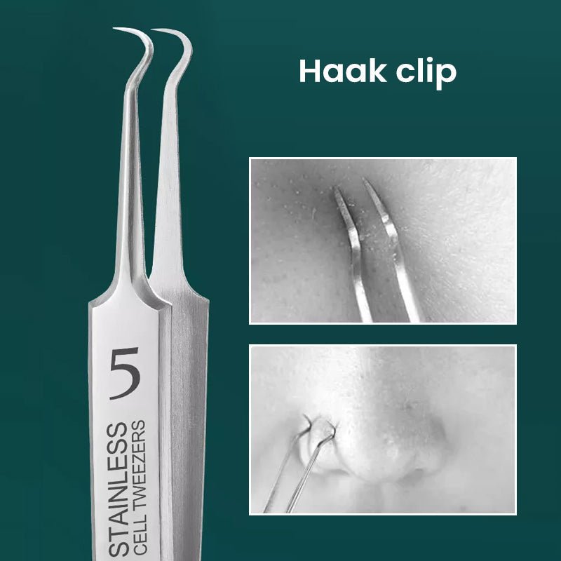 Easy Pimple Removal Tool