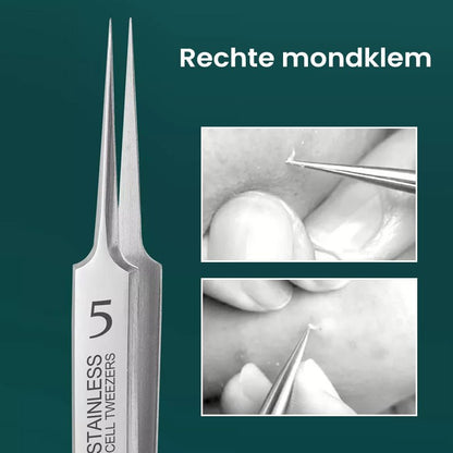 Easy Pimple Removal Tool - Fesara