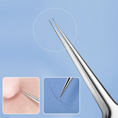 Easy Pimple Removal Tool