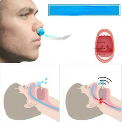 Silent Sleep Anti Snore Clip with Air Purifier