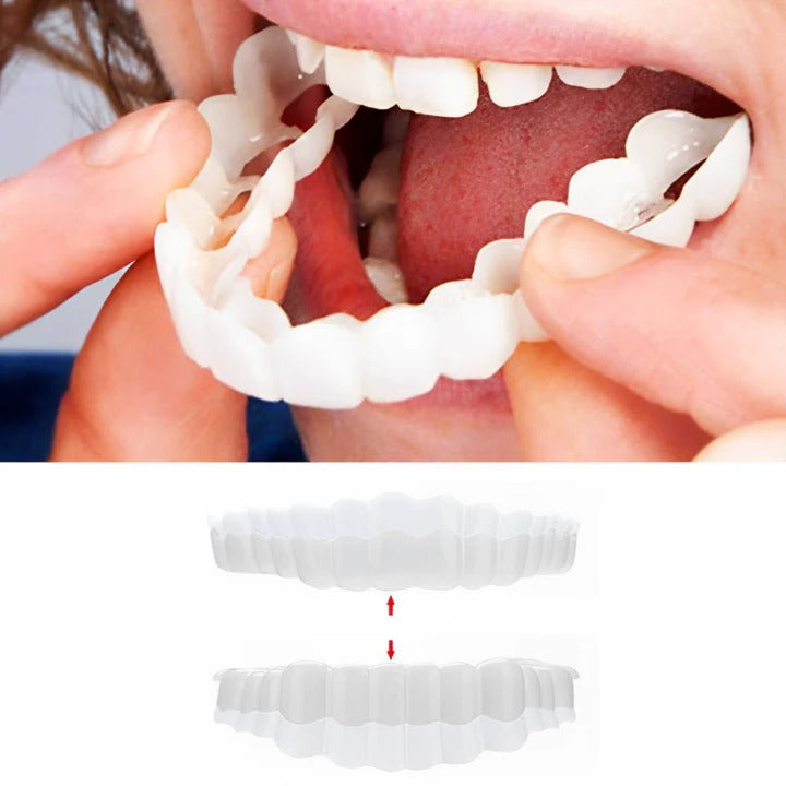 Reusable Snap On Smile Veneers for Top and Bottom Teeth - Fesara