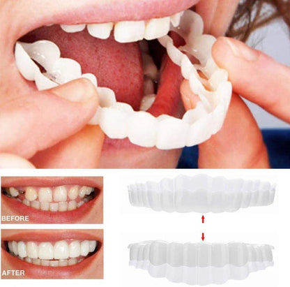 Reusable Snap On Smile Veneers for Top and Bottom Teeth