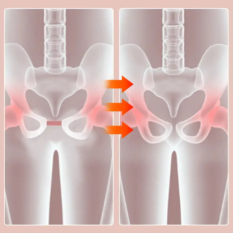 Intimate Fitness Pelvic Exerciser