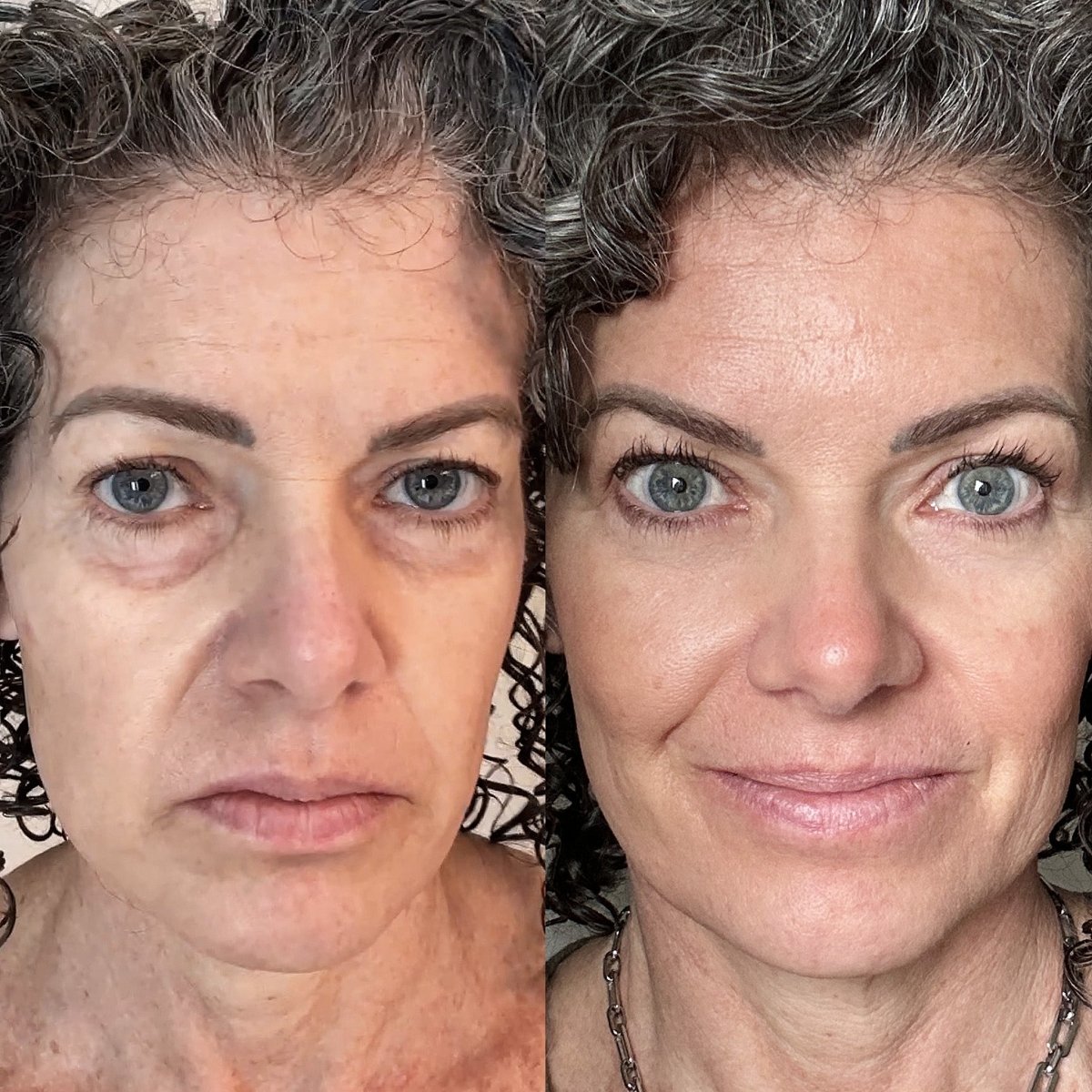 Brightening Eye Cream Revitalizer