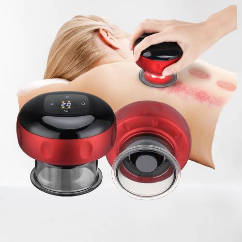 Electric Cupping Therapy Machine - Dynamic Suction & Red Light Heating-3