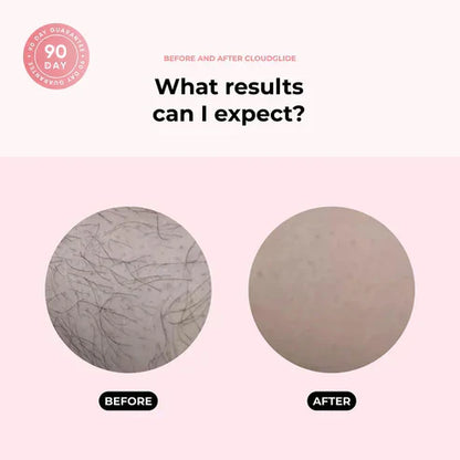 Gentle Hair Remover for Smooth Skin