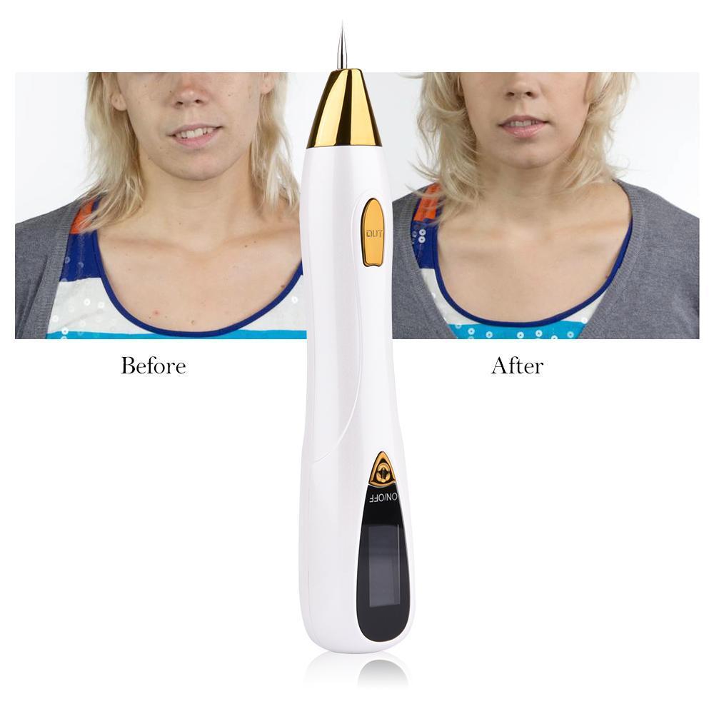 Pro Skin Tag and Mole Removal Cream
