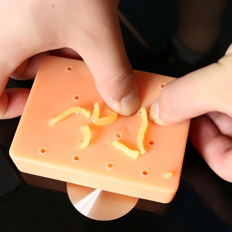 Relaxing Acne Stress Relief Toy - Fesara