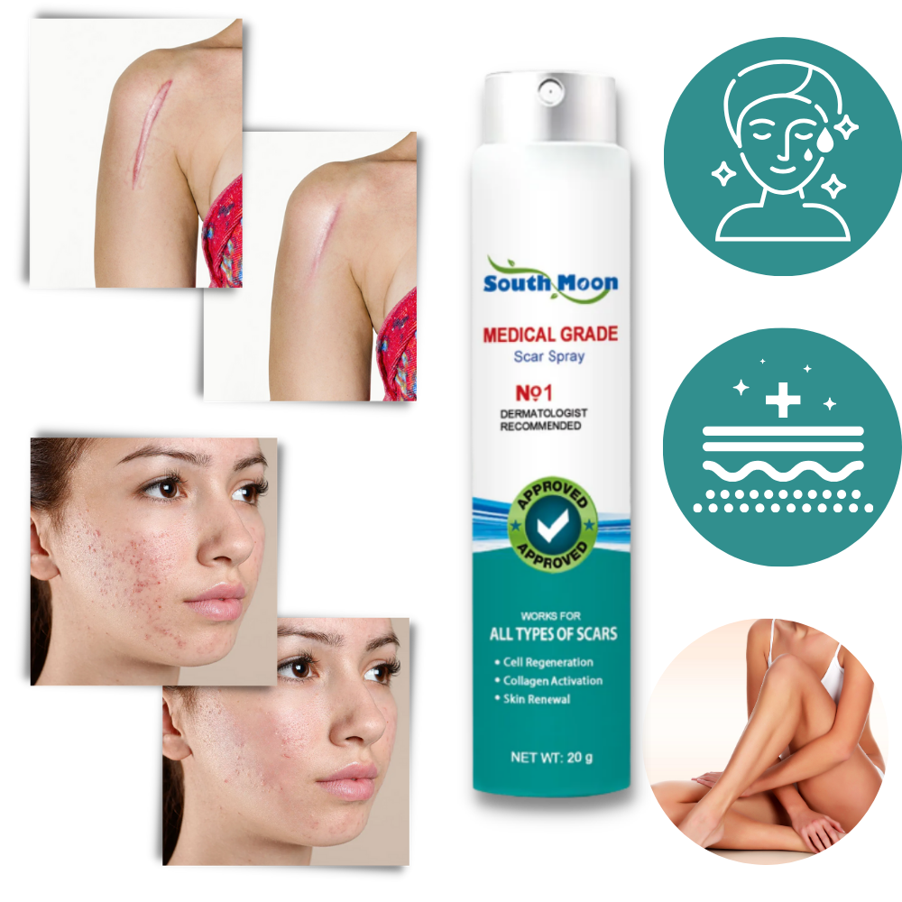 Effective Scar Fade Away Spray