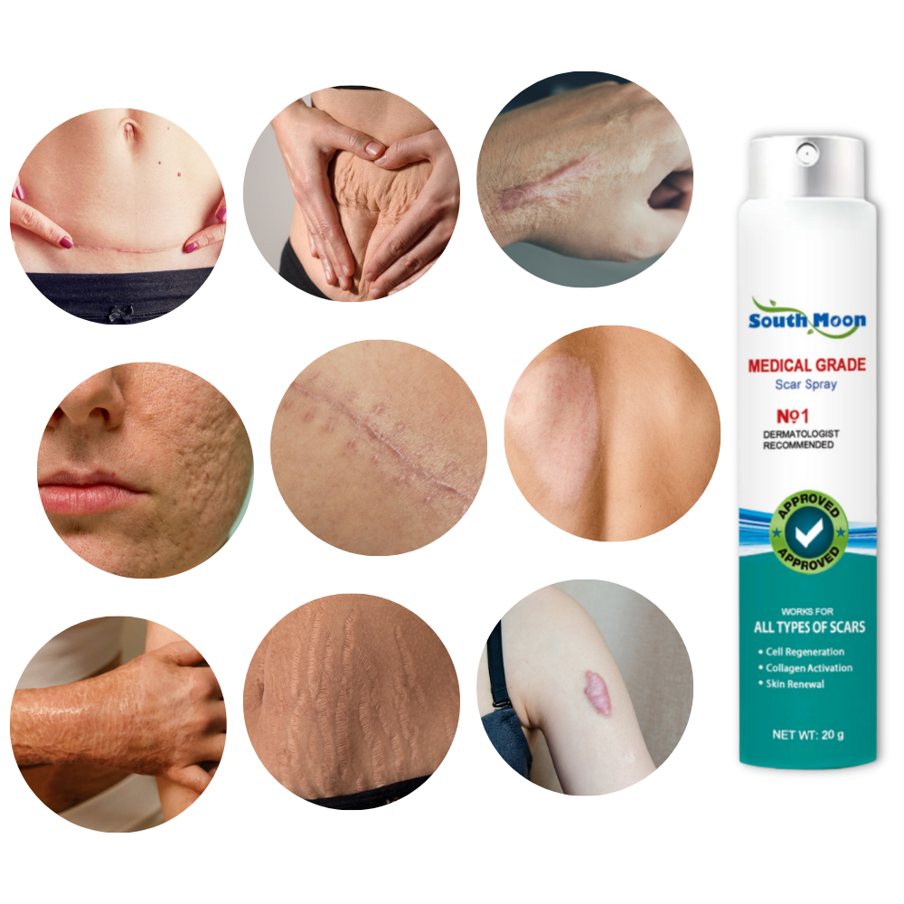 Effective Scar Fade Away Spray