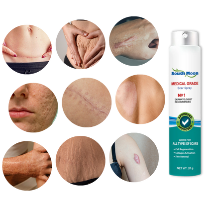 Effective Scar Fade Away Spray