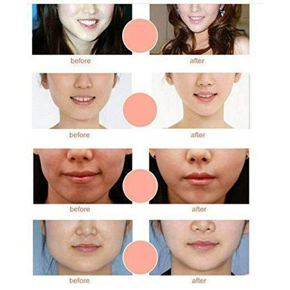 Contouring Face Lift Chin Up Mask