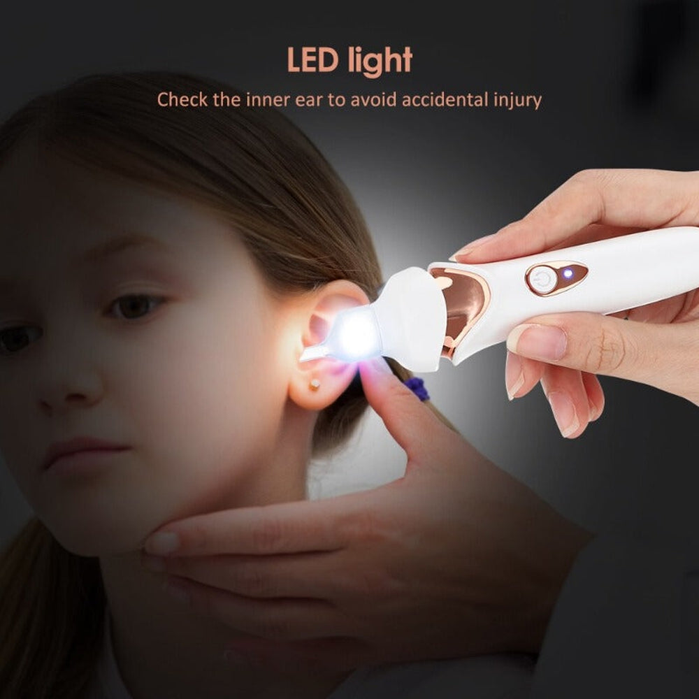 Easy Ear Wax Removal Kit